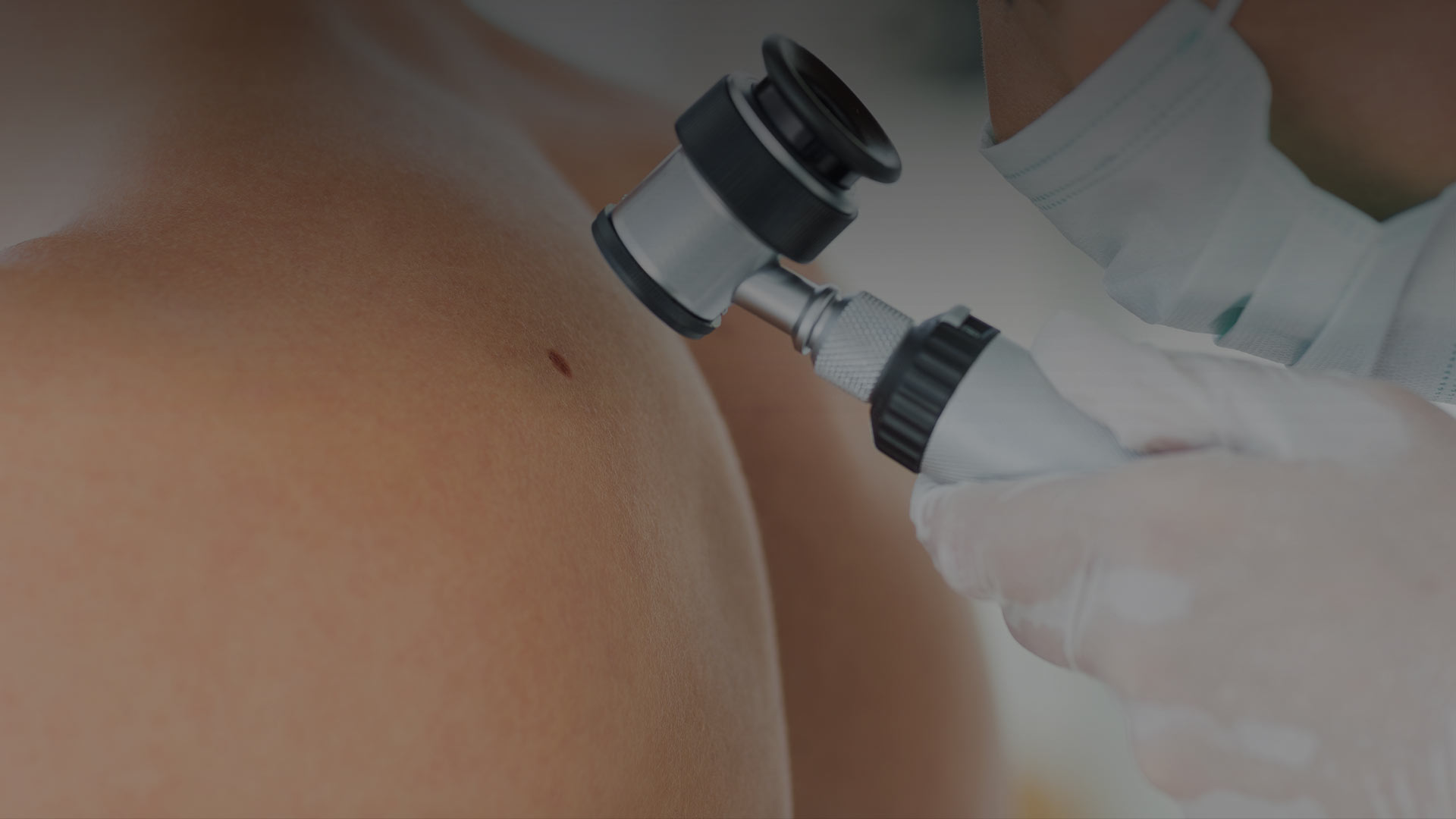 Mole Mapping for Melanoma | Umhlanga & Ballito, Durban | Dr Ishaan ...