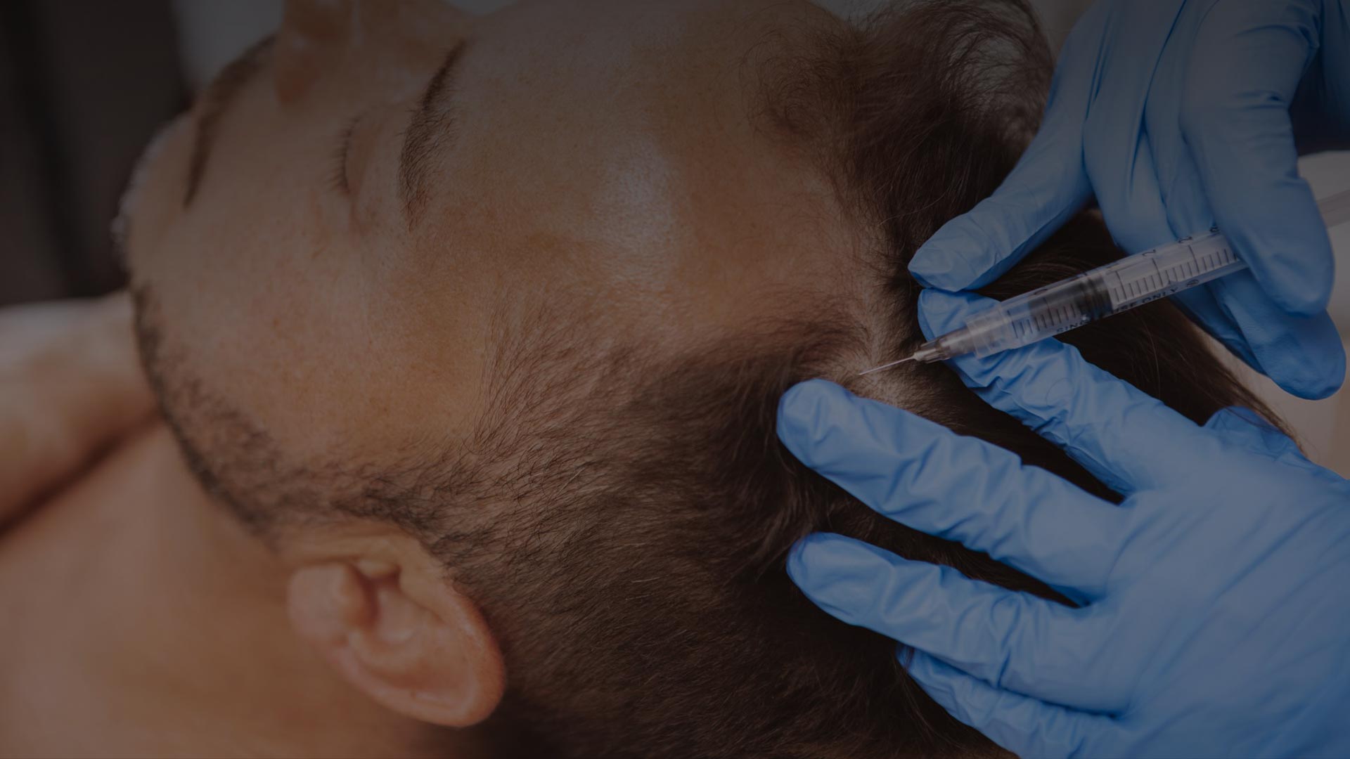 Hair Rejuvenation Treatment | Umhlanga & Ballito, Durban | Dr Ishaan ...